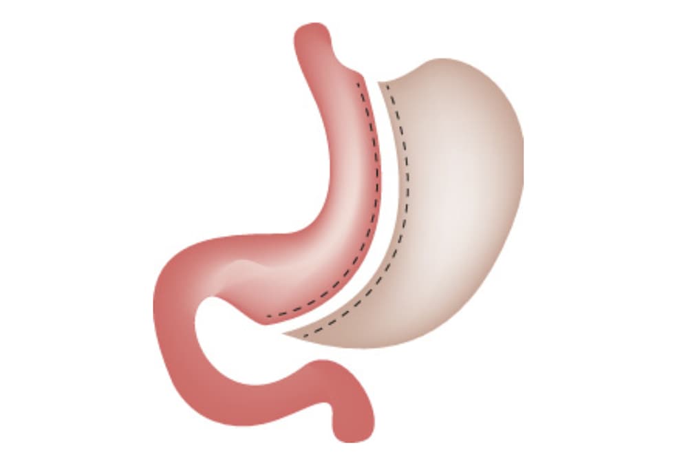 Schéma explicatif d'une Sleeve